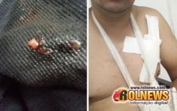 Cacoal:Cinco pessoas foram vítimas de tentativa de roubo linha 5