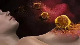 A nova quimioterapia que promete matar o câncer