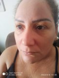 URGENTE: Ex-moradora de Rolim de Moura busca apoio para cirurgia de catarata e...