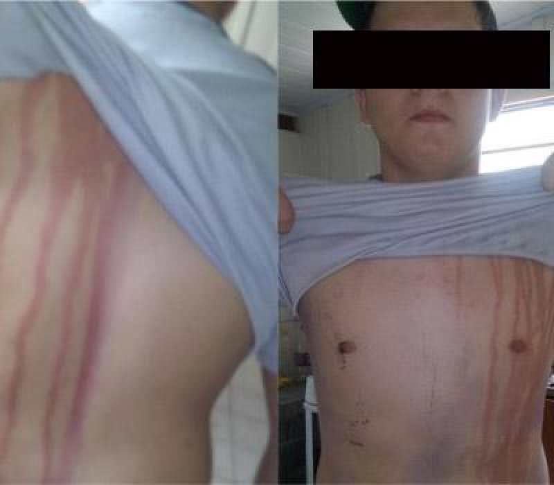 Trote violento manda universitários para o Hospital, em Vilhena