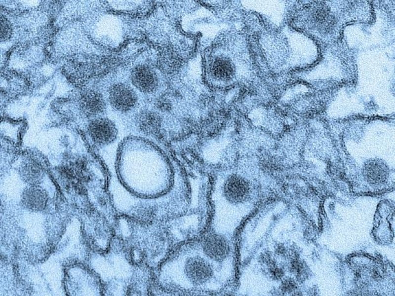 Vírus da zika consegue se esconder do sistema imune, sugere pesquisa