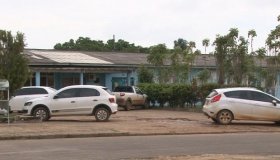 Autoridades de saúde confirmam 1° caso de microcefalia em Rondônia
