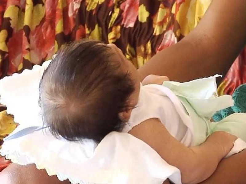 Governo diz que pagará bolsa mensal a famílias de bebês com microcefalia