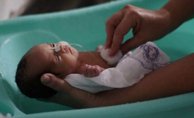 Diagnóstico diferencial de microcefalia pode revelar outras causas além do zika vírus, aponta infectologista do Cemetron