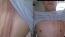 Trote violento manda universitários para o Hospital, em Vilhena