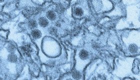 Vírus da zika consegue se esconder do sistema imune, sugere pesquisa