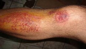 Adolescente é atropelado enquanto jogava Pokémon GO, em Jaru