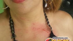 Duas mulheres são agredidas durante dois roubos nesta manhã em Cacoal