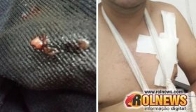 Cacoal:Cinco pessoas foram vítimas de tentativa de roubo linha 5