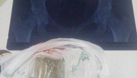 Menos de duas horas após o primeiro flagrante de droga no presídio, outra...