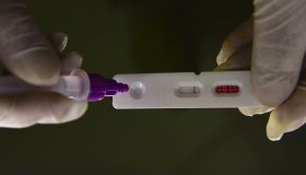Hospitalizações por covid-19 mantêm tendência de alta nos estados