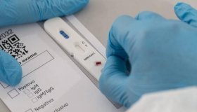 Pais tem 3.379 novos casos de covid-19 e 4 mortes nas últimas 24 horas