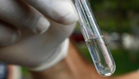 Com 987 mortes por dengue em 2022, Brasil bate recorde em letalidade anual