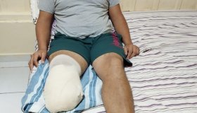 AJUDA: Jovem de Migrantinópolis precisa arrecadar mais de R$ 45 mil reais para...