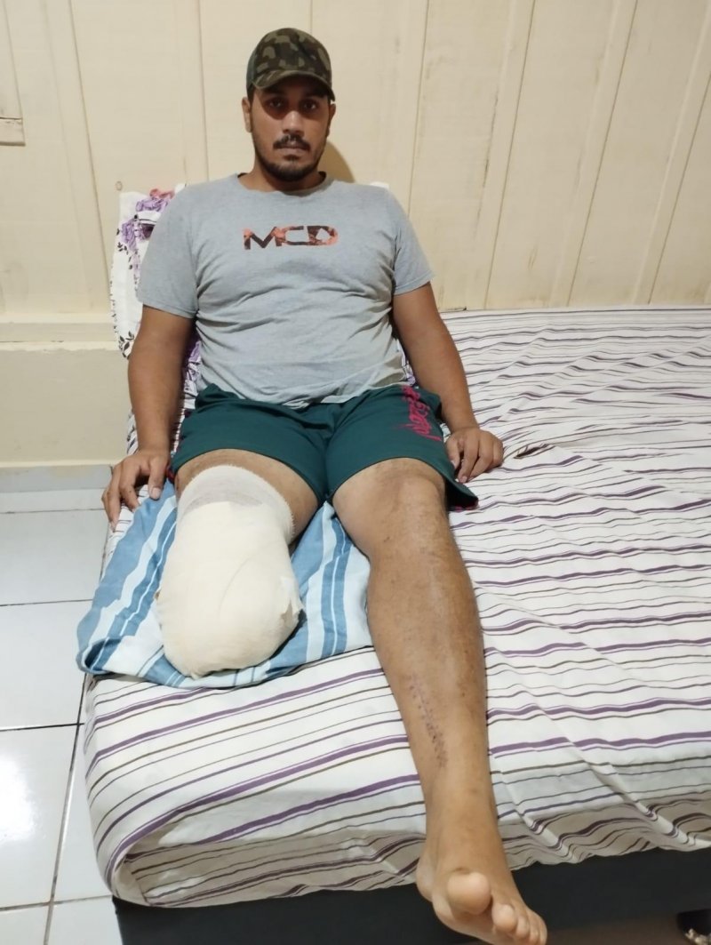 AJUDA: Jovem de Migrantinópolis precisa arrecadar mais de R$ 45 mil reais para pagar cirurgias