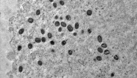 Pesquisa indica risco de monkeypox agravar infeccão por HIV