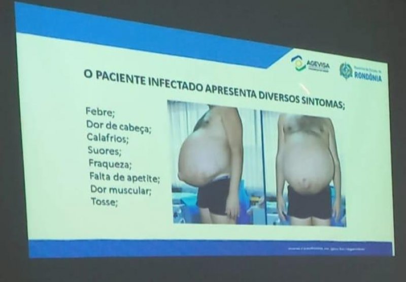 Profissionais da Atenção Básica de Saúde em Rolim de Moura são capacitados sobre Leishmaniose e Esquistossomose