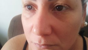 URGENTE: Ex-moradora de Rolim de Moura busca apoio para cirurgia de catarata e...