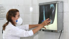 Governo cria comitê para reduzir casos de tuberculose até 2030