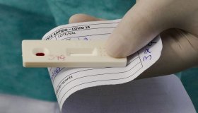 Rolim de Moura: Testes de covid-19 passarão a ser realizados apenas nos postos...