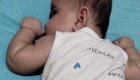 A pequena Hellena Brunieri, de apenas 01 ano precisa de sua ajuda através de...