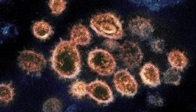 Covid: variante Éris é confirmada pela primeira vez no Brasil