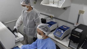 Pesquisadores da Fiocruz criam método para detectar hepatite D