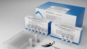 A pedido do Ministério da Saúde, Fiocruz dobra produção de testes para...