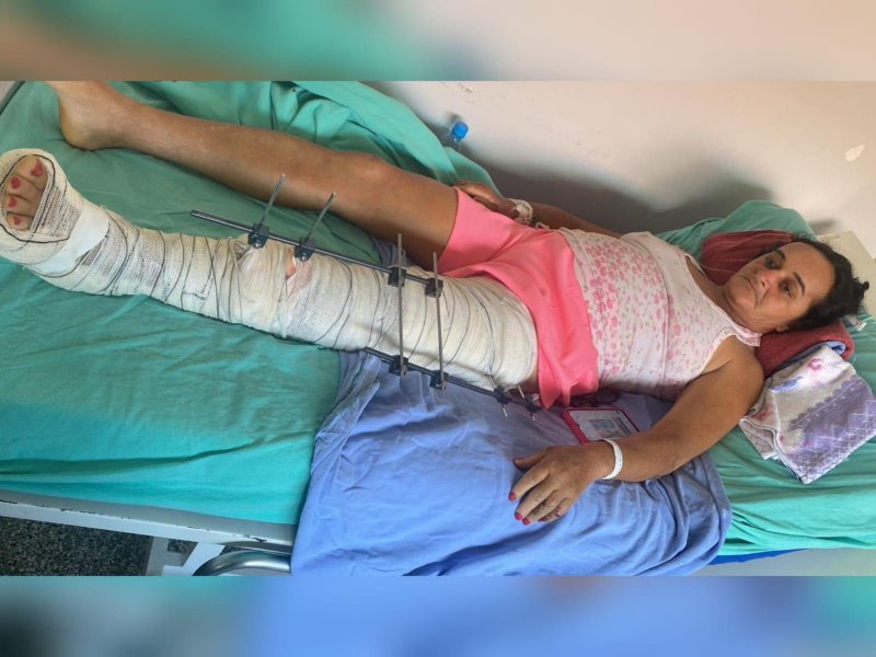 Doe sangue: Mulher vítima de acidente em Rolim de Moura precisa urgentemente de sangue tipo A-