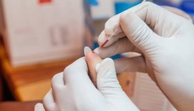 Nova variante do HIV circula em três estados do Brasil, diz estudo