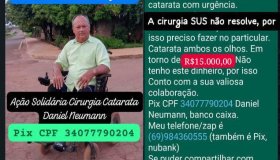 Apoio Necessário para Cirurgia de Catarata