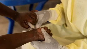 Vacina brasileira contra a mpox está próxima dos testes em humanos