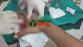 Morador de rua é agredido covardemente com tijoladas enquanto dormia em...