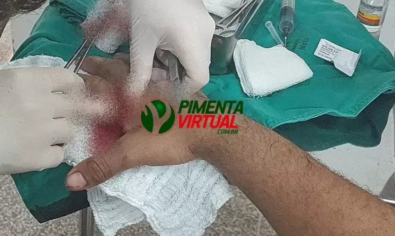 Morador de rua é agredido covardemente com tijoladas enquanto dormia em calçada em Pimenta Bueno