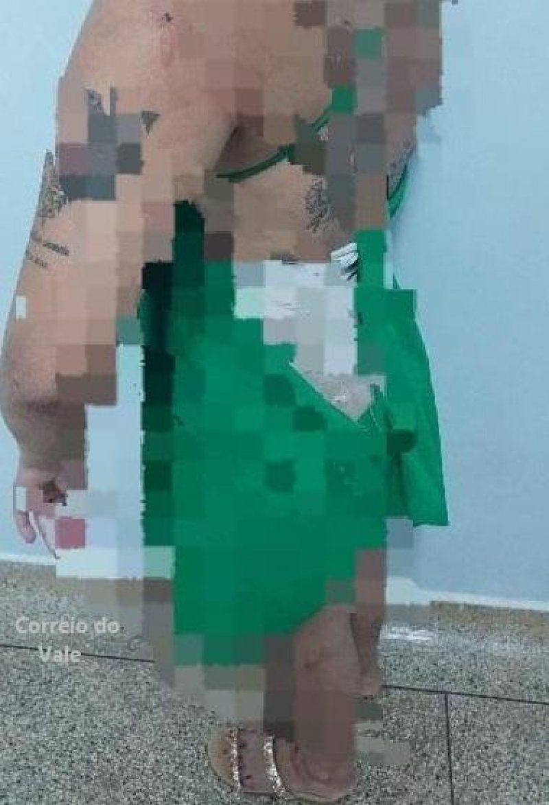 Mulher é vítima de agressões por quatro pessoas em Seringueiras
