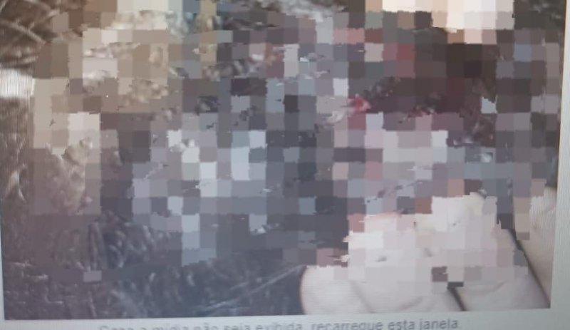 Jovem de 23 anos é agredida com taco de sinuca em bar de São Miguel do Guaporé