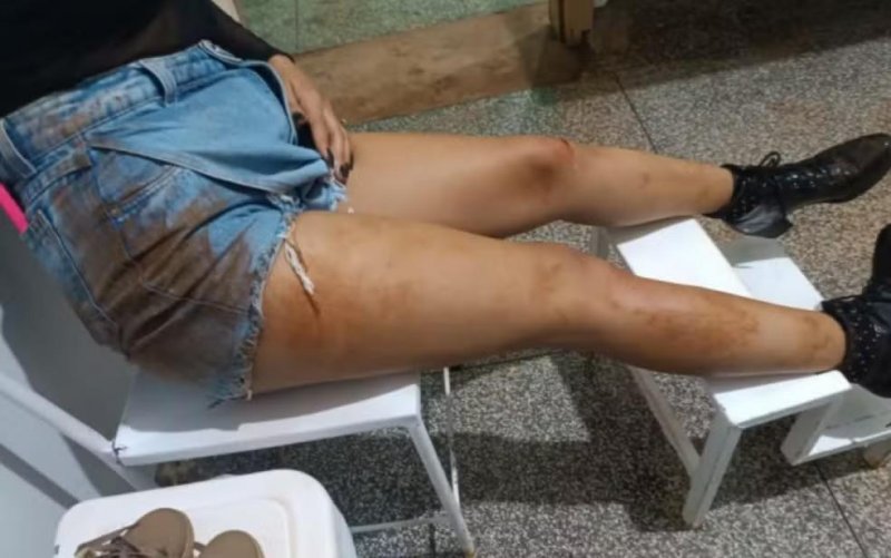 MÃE DENUNCIOU: Patamo detém adolescente que espancou esposa de 17 anos