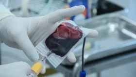 Férias agravam baixa nos estoques e Hemocentro pede doação urgente de sangue...