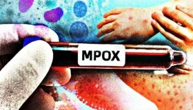 Mpox: casos sobem para oito em Rondônia; criança está entre infectados