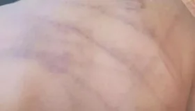 Bebê de 1 ano é internado com sinais de espancamento em Barra do Garças