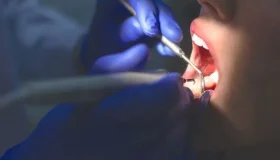 Justiça proíbe definitivamente dentista de realizar cirurgias exclusivas de...