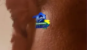 Homem tem parte da orelha arrancada e fica gravemente ferido após ataque com...