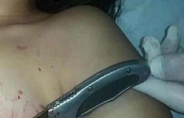 RONDÔNIA - Homem não aceita fim de relacionamento e crava canivete no peito da ex-mulher
