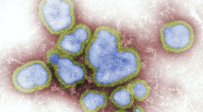 Mais três mortes por gripe são confirmadas em Rondônia