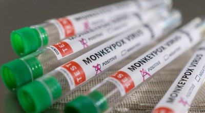 Dois meses após primeiro caso de varíola do macaco, Brasil contabiliza quase 2.300 infectados