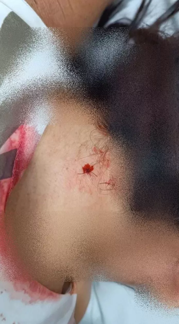 Homem armado com garfo fere vítima em estabelecimento durante assalto e é capturado pela Polícia Militar em Pimenta Bueno