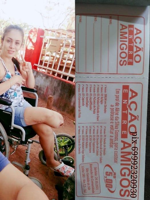Moradora de Rolim de Moura pede ajuda em Ação Solidária para compra de prótese na perna