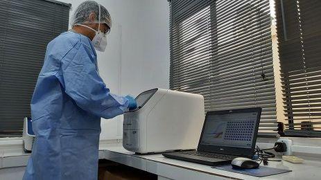 Pesquisadores da Fiocruz criam método para detectar hepatite D Pesquisadores da Fiocruz criam método para detectar hepatite D