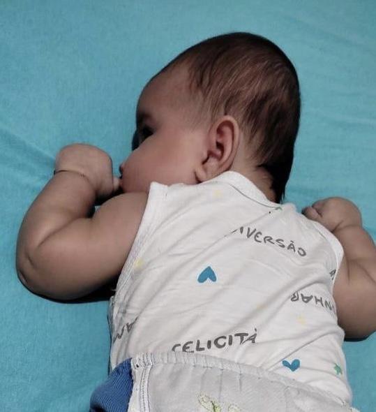A pequena Hellena Brunieri, de apenas 01 ano precisa de sua ajuda através de uma vakinha On Line 
