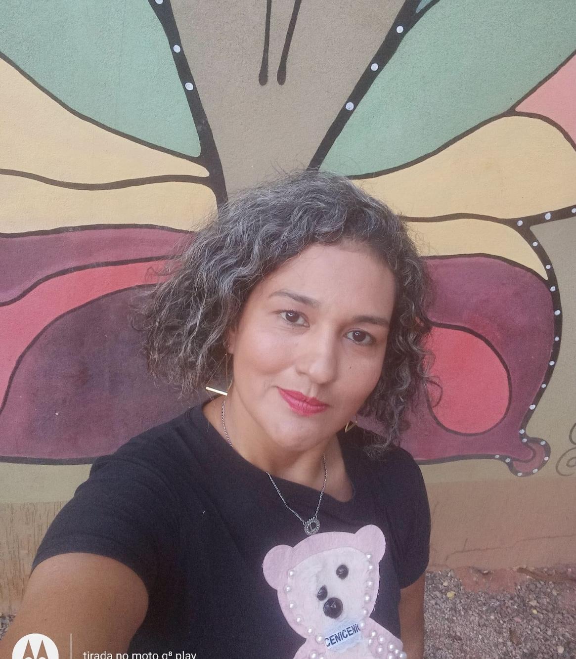 Moradora de Rolim de Moura, que sofreu acidente no mês de julho morre em Cacoal. Prefeitura emitiu pesar Moradora de Rolim de Moura, que sofreu acidente no mês de julho morre em Cacoal. Prefeitura emitiu pesar